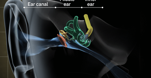 From Symptoms to Solutions: Navigating CSF Leaks in Your Ears