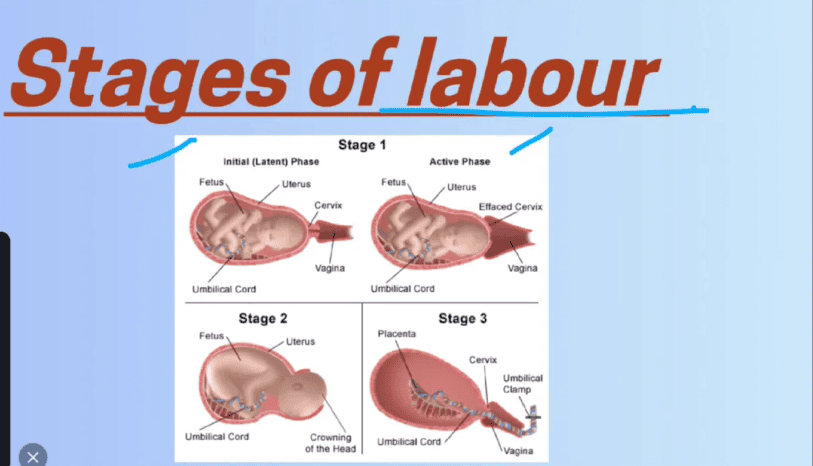 Normal Labour Explained: A Step-by-Step Guide to Signs, Stages and Progress